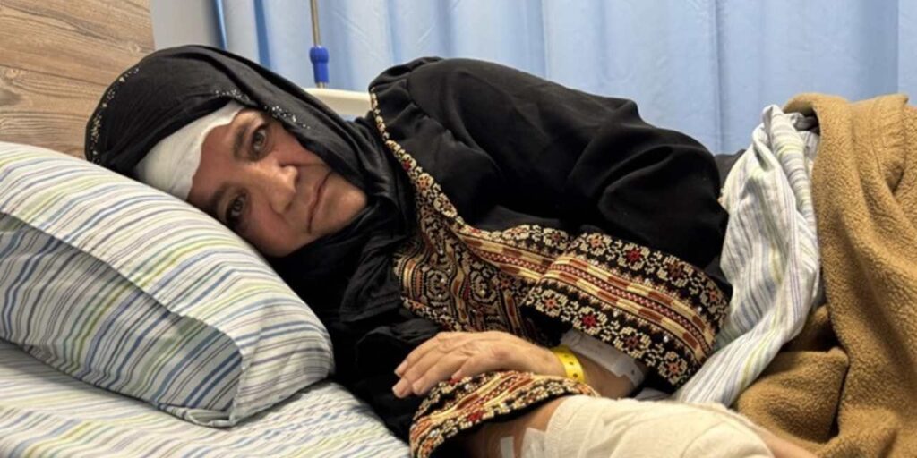 İsrail’de faşist saldırı: Filistinli kadını sopayla darp ederek bayılttı