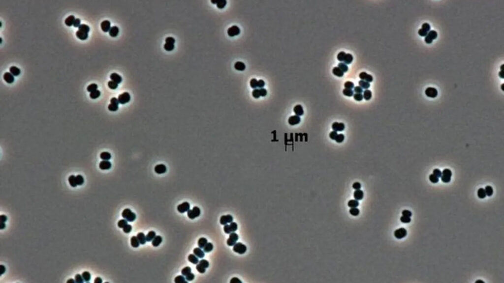 Ölü taklidi yapan süper bakteriler, uzayı bile tehdit ediyor